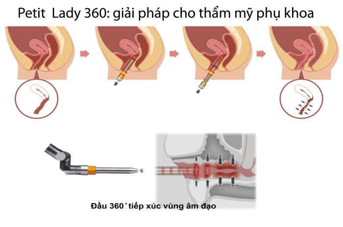 Bệnh viện thẩm mỹ vùng kín