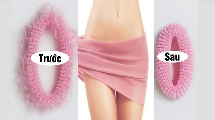 Làm hồng vùng kín phụ nữ