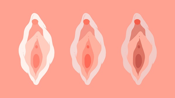 Se khít vùng kín tự nhiên