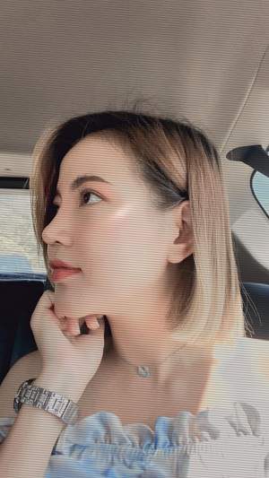 Nâng mũi Bác Sĩ nào đẹp