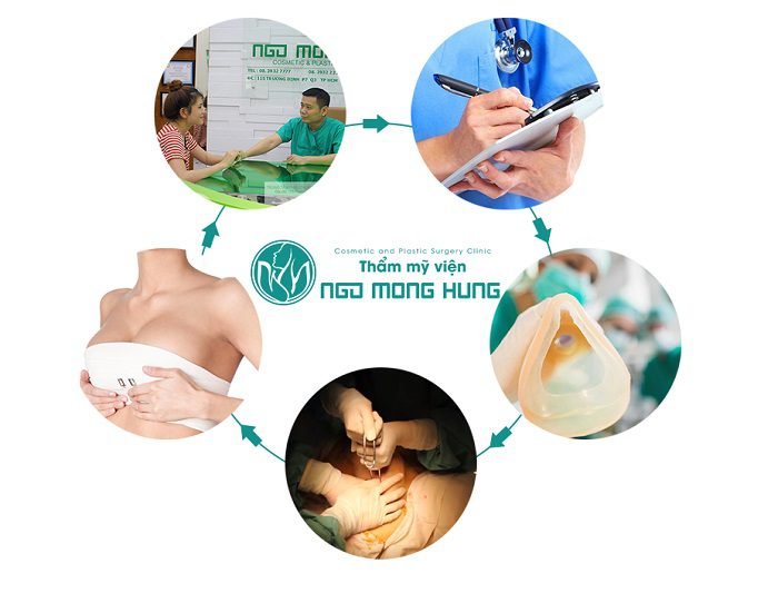 Giá phẫu thuật nâng ngực nội soi