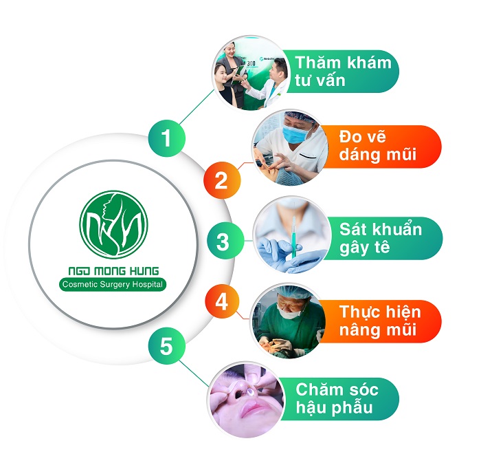 Nên nâng mũi bọc sụn hay Sline Nên nâng mũi bọc sụn hay Sline