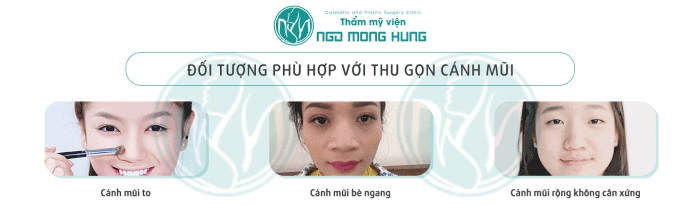 Thu gọn cánh mũi có ảnh hưởng gì không
