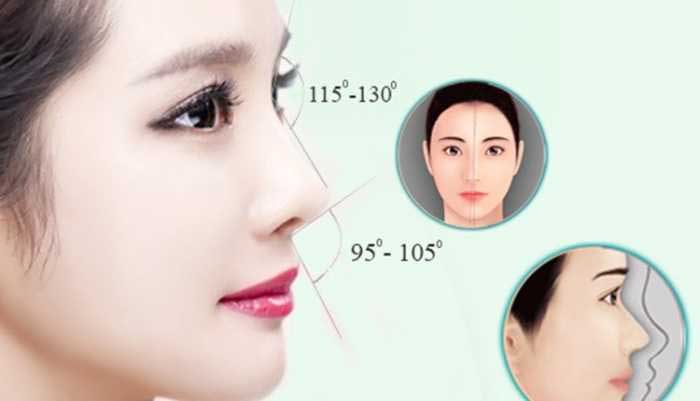 Địa chỉ phẫu thuật nâng mũi đẹp ở Hà Nội