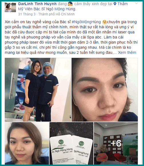 Hút mỡ mắt bụp