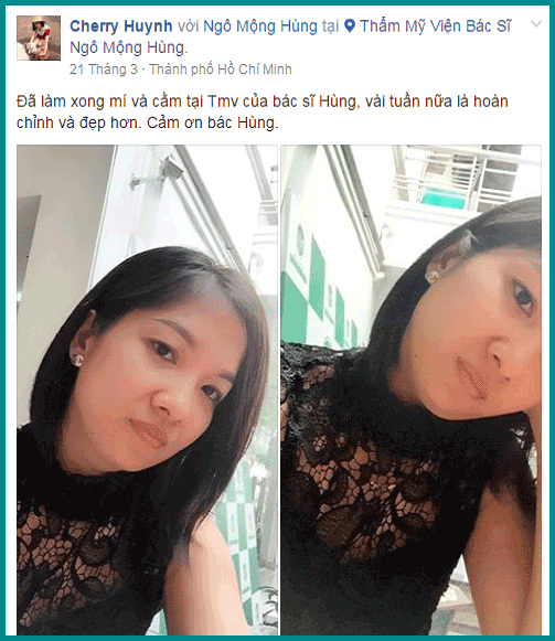 Bóc bọng mỡ mắt