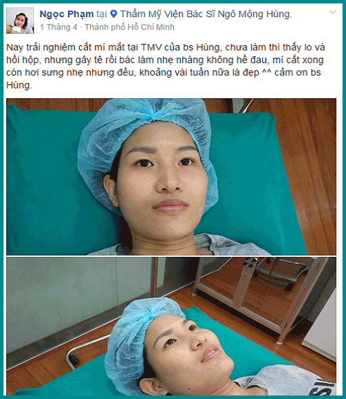 Đuôi mắt xếch lên
