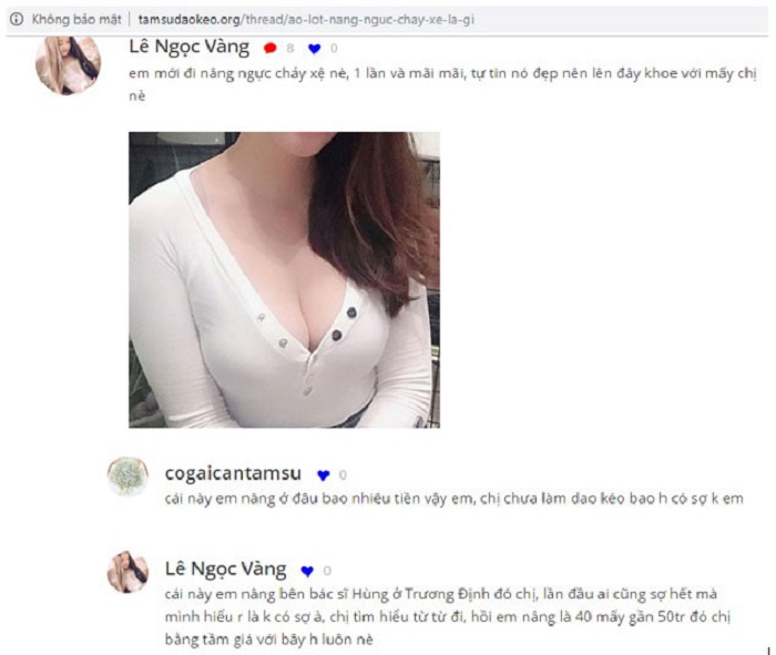 Giá cả nâng ngực