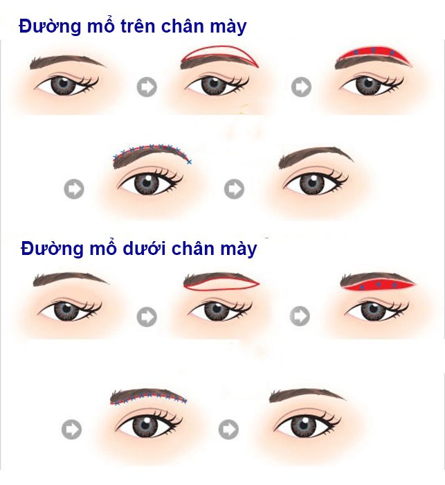 Giá treo lông mày