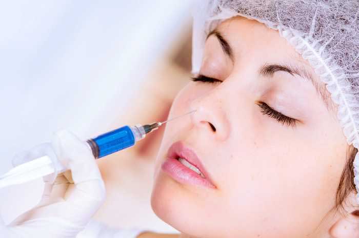 Bán kẹp nâng mũi Hà Nội