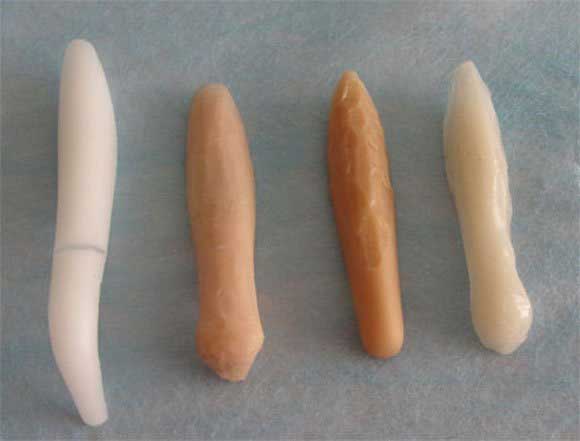 Nâng mũi nam giới