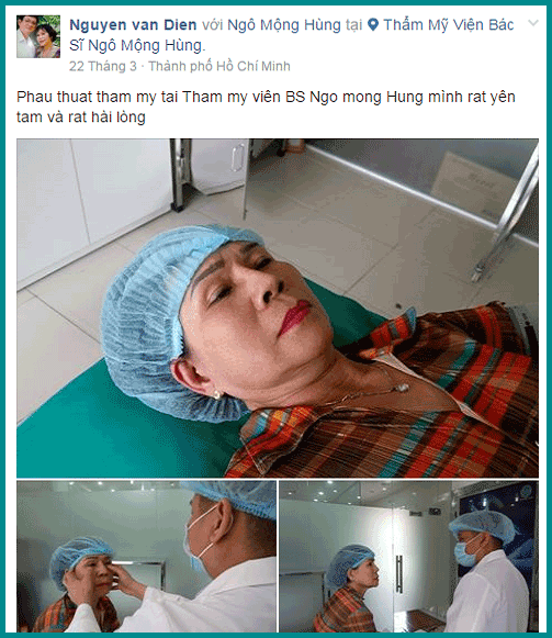 Hốc mắt sâu phải làm sao