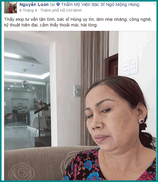 Hốc mắt sâu phải làm sao