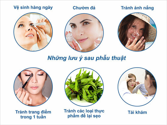 Kiêng ăn gì sau khi phẫu thuật mắt