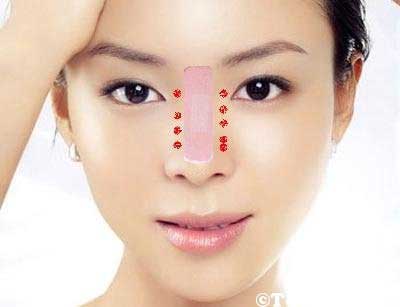 Miếng dán nâng cao mũi