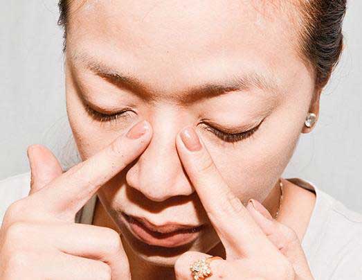 Nâng mũi juvederm