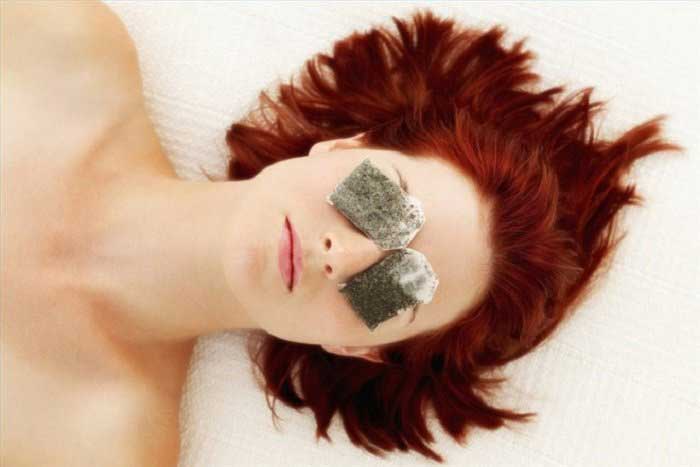 Cách trị bọng mỡ dưới mắt