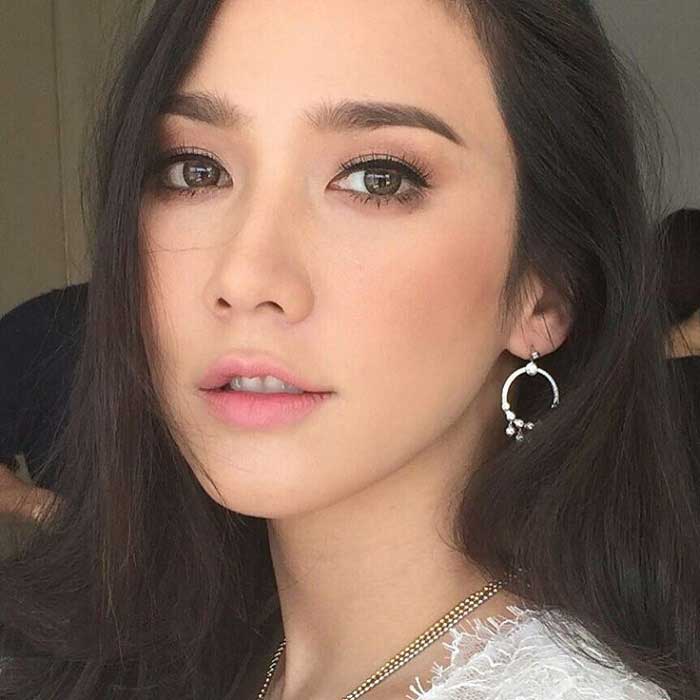 Chữa mũi hếch
