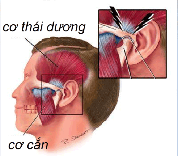 Nâng mũi bọc cân ở đâu đẹp