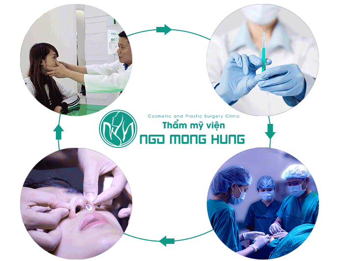 Phẫu thuật nâng mũi webtretho