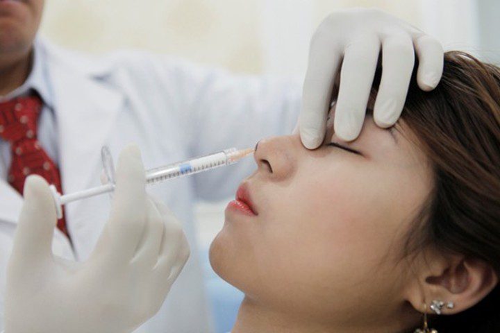 Nâng mũi để đổi tướng