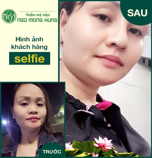 Làm thế nào để thu nhỏ đầu mũi