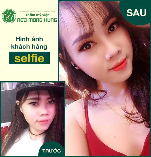 Bài tập thu nhỏ đầu mũi