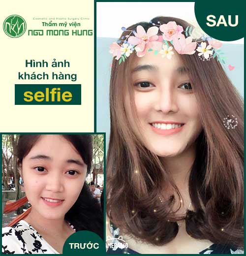 Hình ảnh thu nhỏ đầu mũi