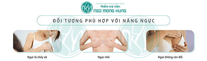 Miếng nâng ngực bằng silicon