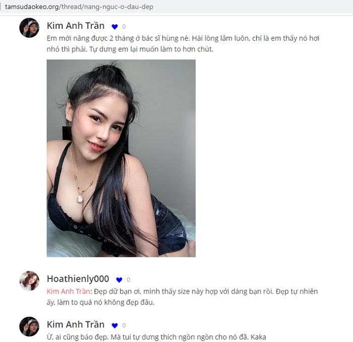 Nâng ngực an toàn