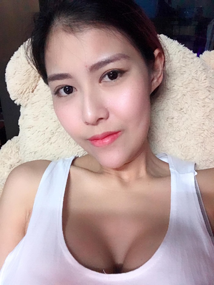 nâng ngực chảy xệ giá bao nhiêu nâng ngực chảy xệ giá bao nhiêu