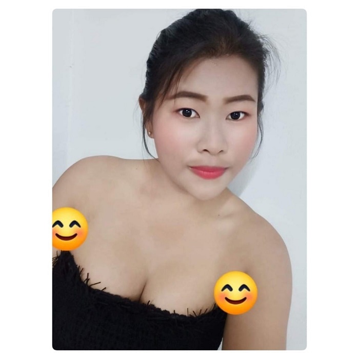 Nâng ngực có cho con bú được không