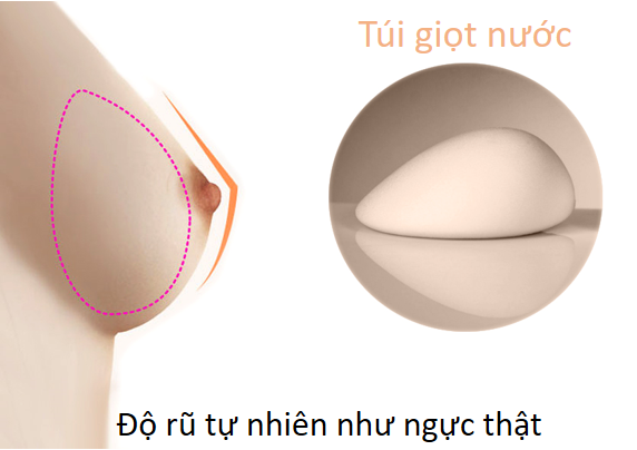 nâng ngực hàn quốc