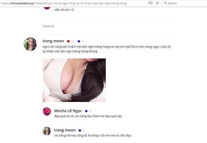 Nâng ngực hết bao nhiêu tiền