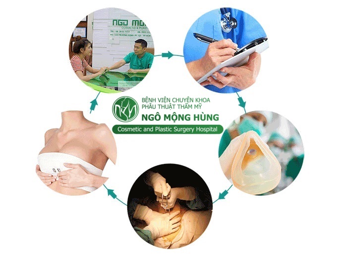 Nâng ngực nội soi là gì