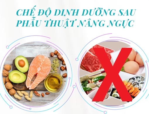 Cách trị ngực chảy xệ