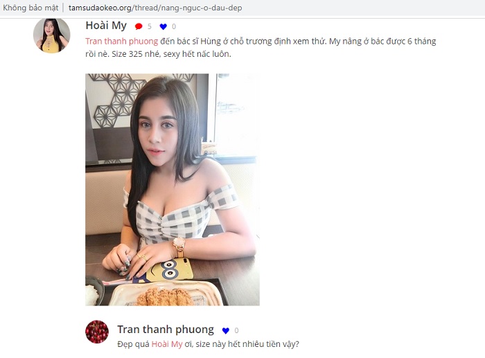 Nâng ngực webtretho Nâng ngực webtretho