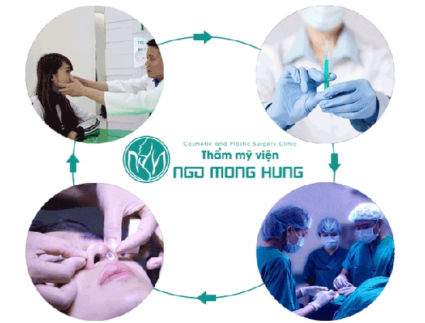 Thu gọn cánh mũi có để lại sẹo