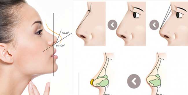 Nâng mũi chỗ nào đẹp nhất