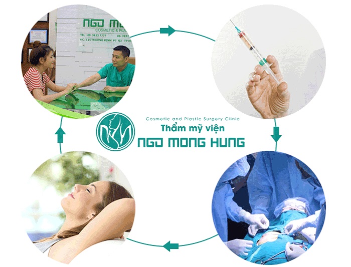 Giá thu nhỏ núm vú