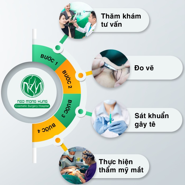 Kiêng ăn gì sau khi phẫu thuật mắt