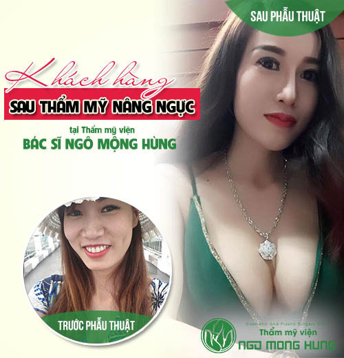 Thuốc nở ngực có hại không