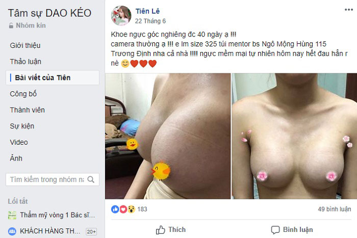 Thuốc nở ngực có hại không