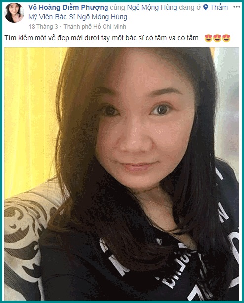 Giá thu nhỏ núm vú