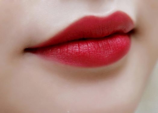 Thẩm mỹ làm hồng môi