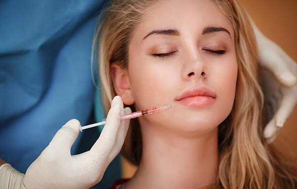 Xóa nếp nhăn nơi khóe miệng