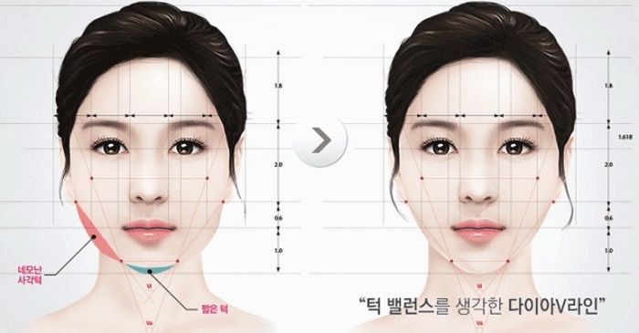 Hạ gò má ở đâu đẹp