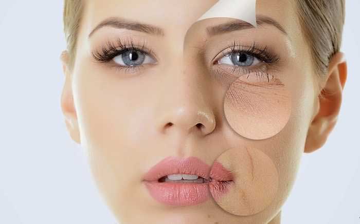 Xóa nếp nhăn dưới mắt