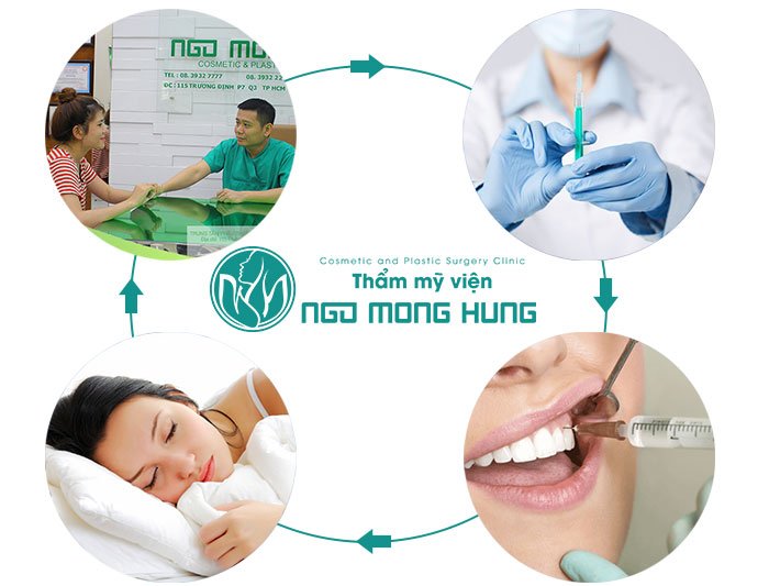 Nhân tướng học cười hở lợi