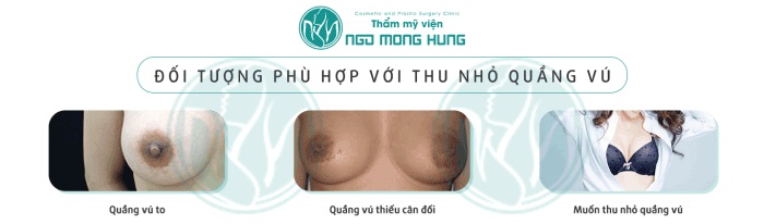 Thu nhỏ quầng vú ở đâu